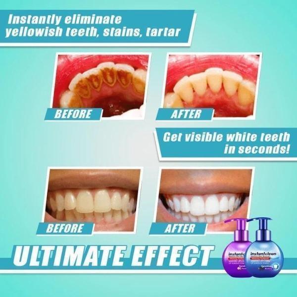 InstantClean™ Stain Removal Toothpaste