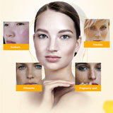 Pigmentation and Freckle Repair Facial Cream
